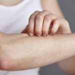 Bạn đã biết nguyên nhân và cách phòng tránh bệnh di ứng nước chưa